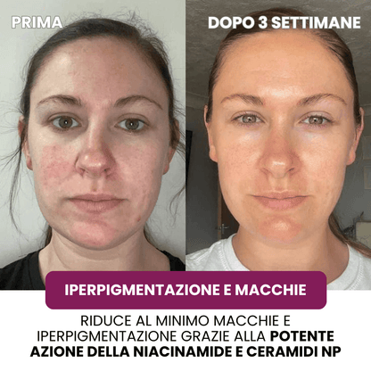 Regenerating Mask with Hydrolyzed Collagen &amp; Niacinamide