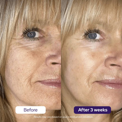 Hydrolyzed Collagen Age Defying Mask - PROMO