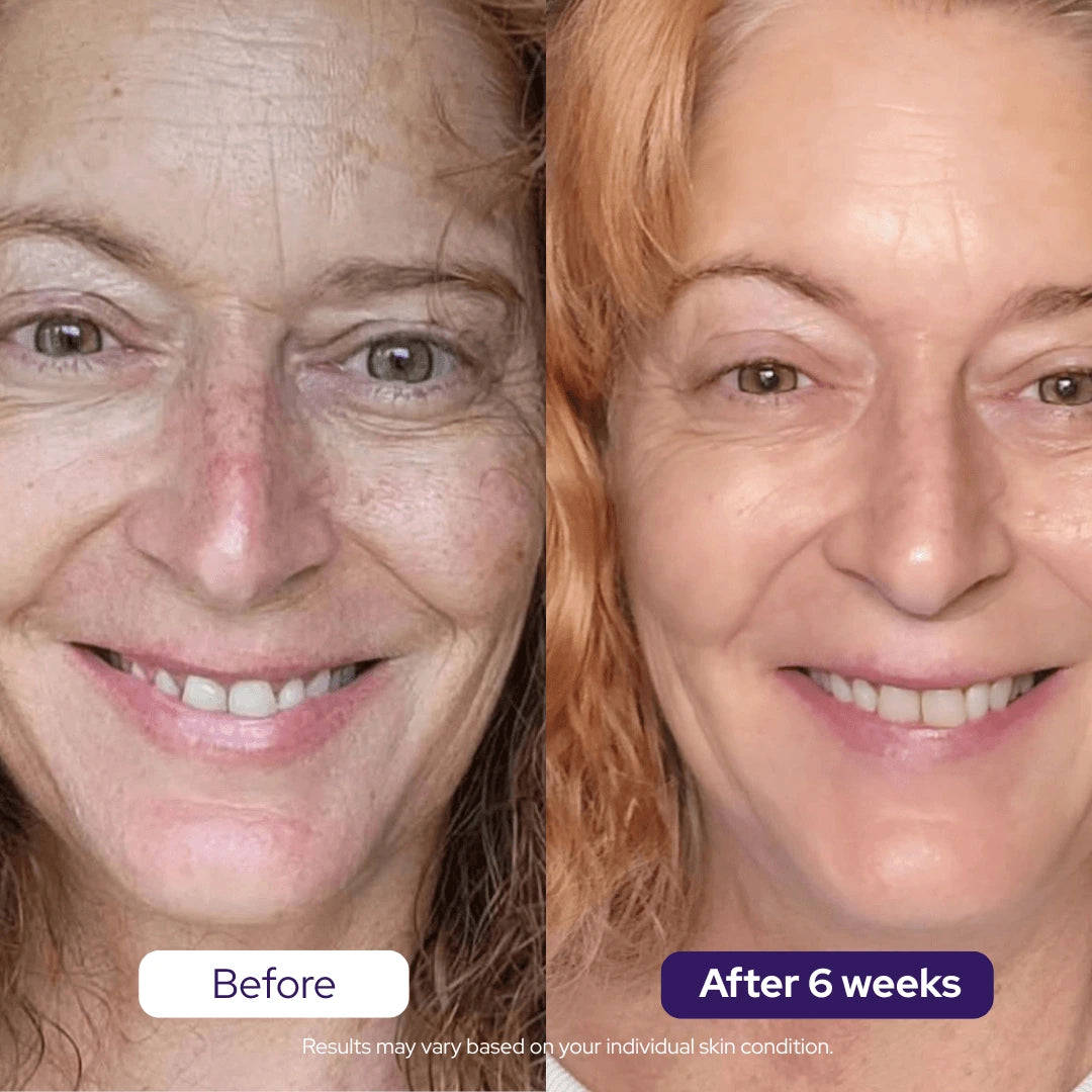 Hydrolyzed Collagen Age Defying Mask - PROMO