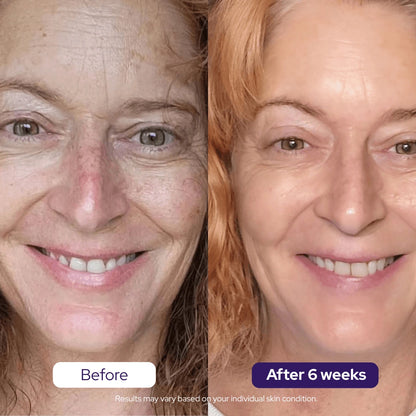 Hydrolyzed Collagen Age Defying Mask - PROMO