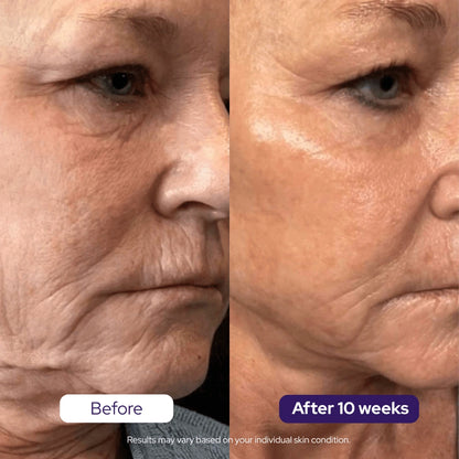 Hydrolyzed Collagen Age Defying Mask - PROMO
