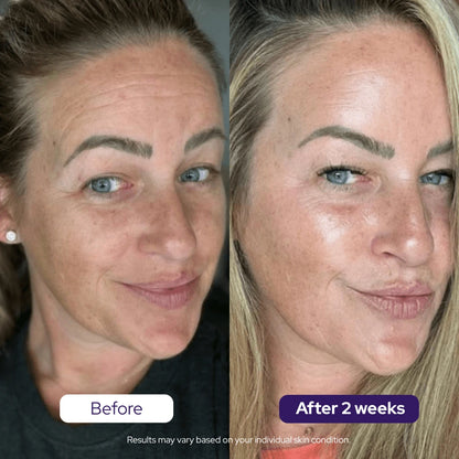 Hydrolyzed Collagen Age Defying Mask - PROMO