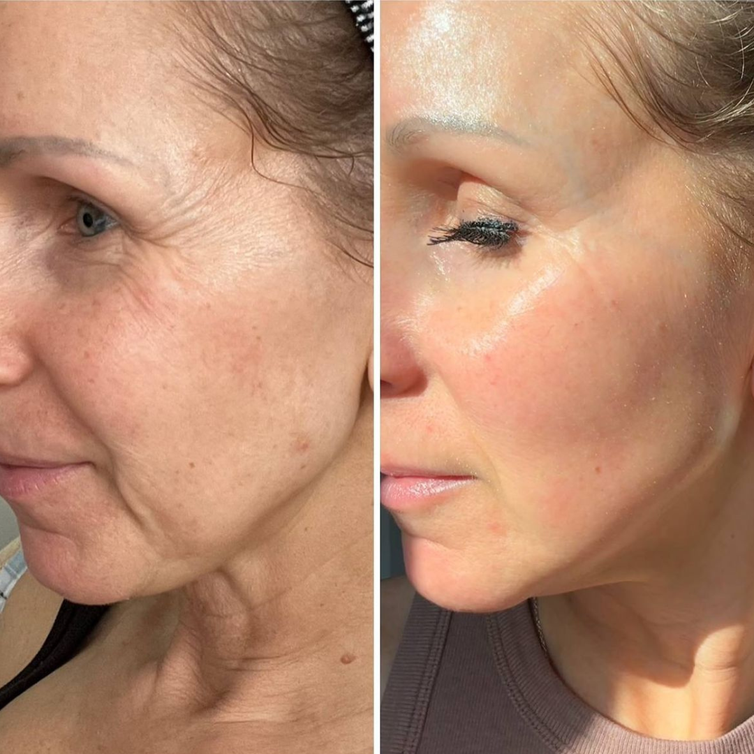 Masque réparateur au collagène et à la niacinamide