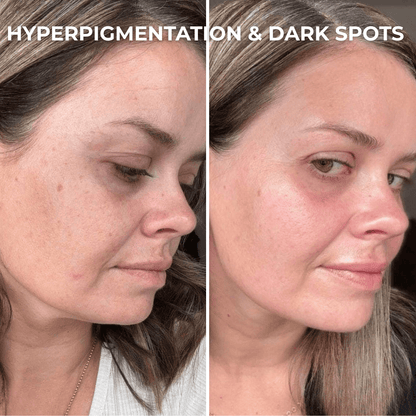 PDRN Collagen Peptides Hydrogel Mask