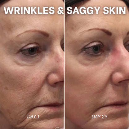 PDRN Collagen Peptides Hydrogel Mask