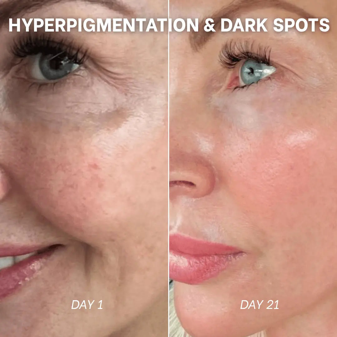 PDRN Collagen Peptides Hydrogel Mask