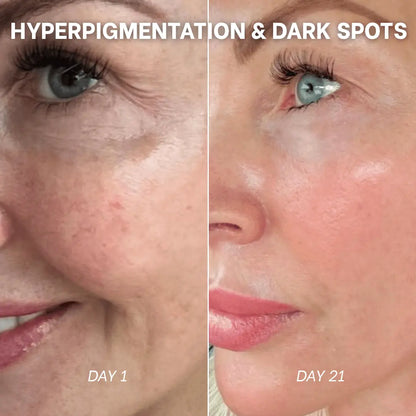 PDRN Collagen Peptides Hydrogel Mask