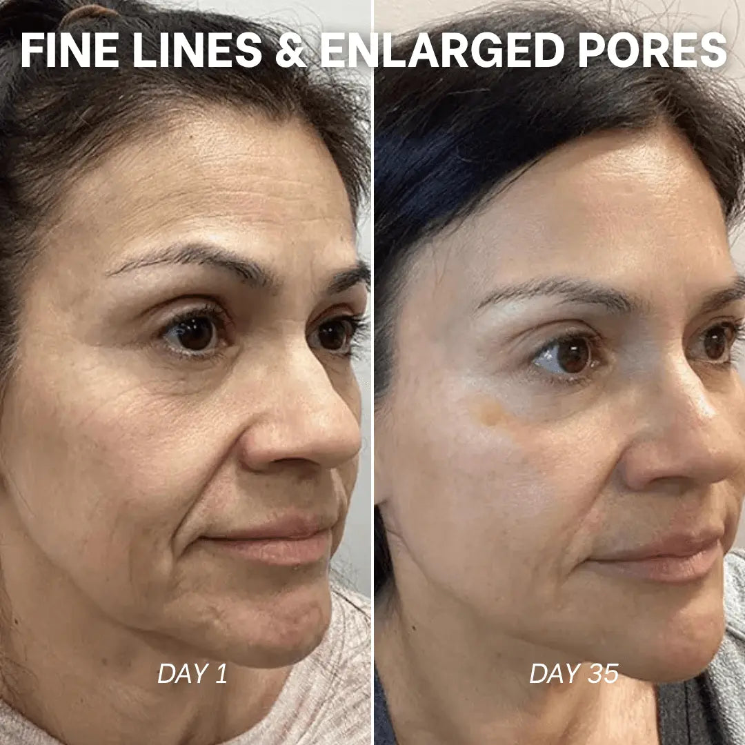 PDRN Collagen Peptides Hydrogel Mask