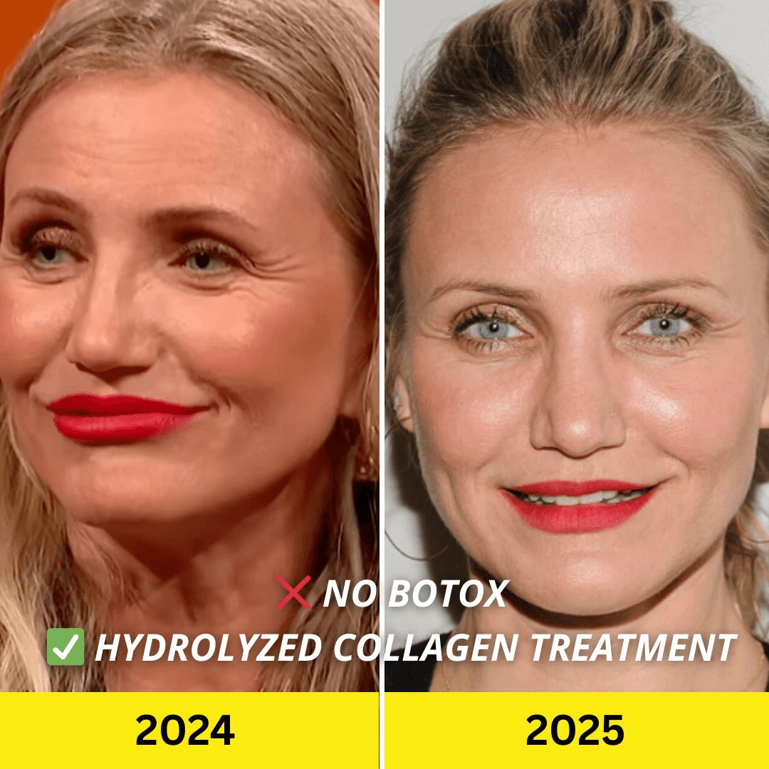 8. BONUS : C'est une alternative efficace au Botox