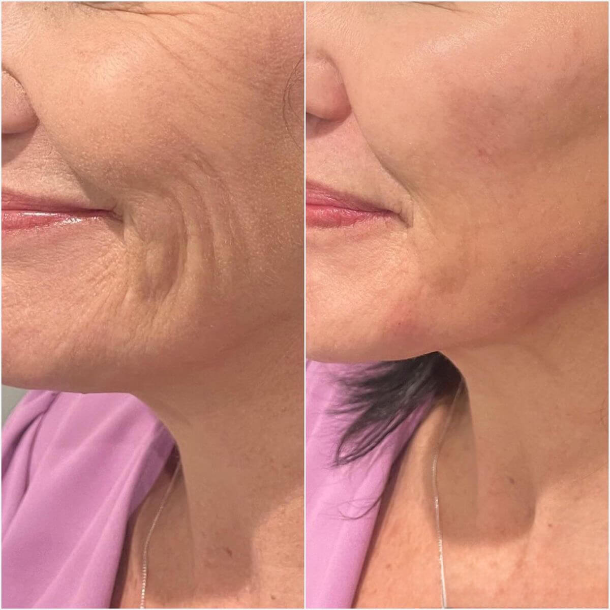 Masque réparateur au collagène et à la niacinamide