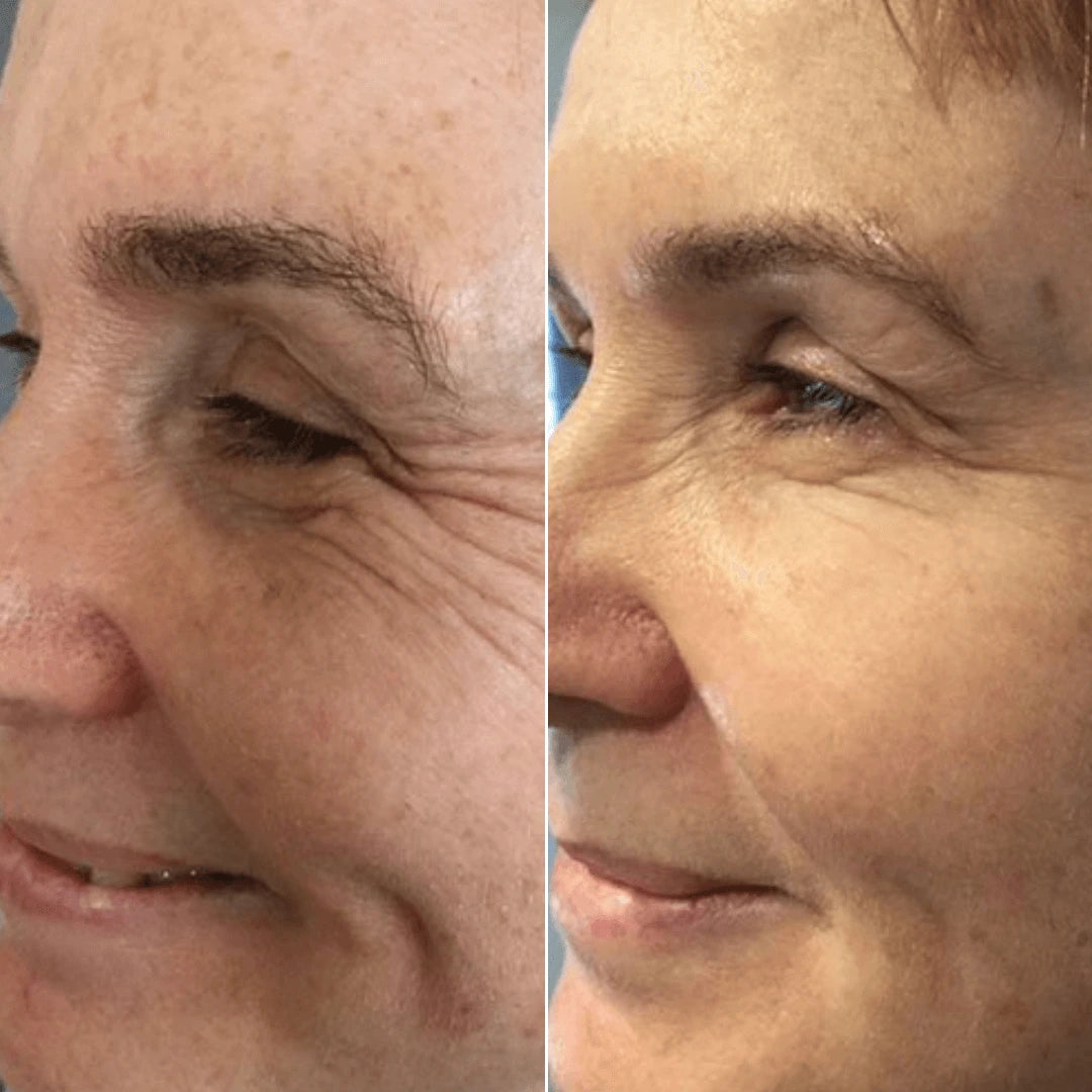 Masque réparateur au collagène et à la niacinamide